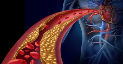 hyperlipidemia